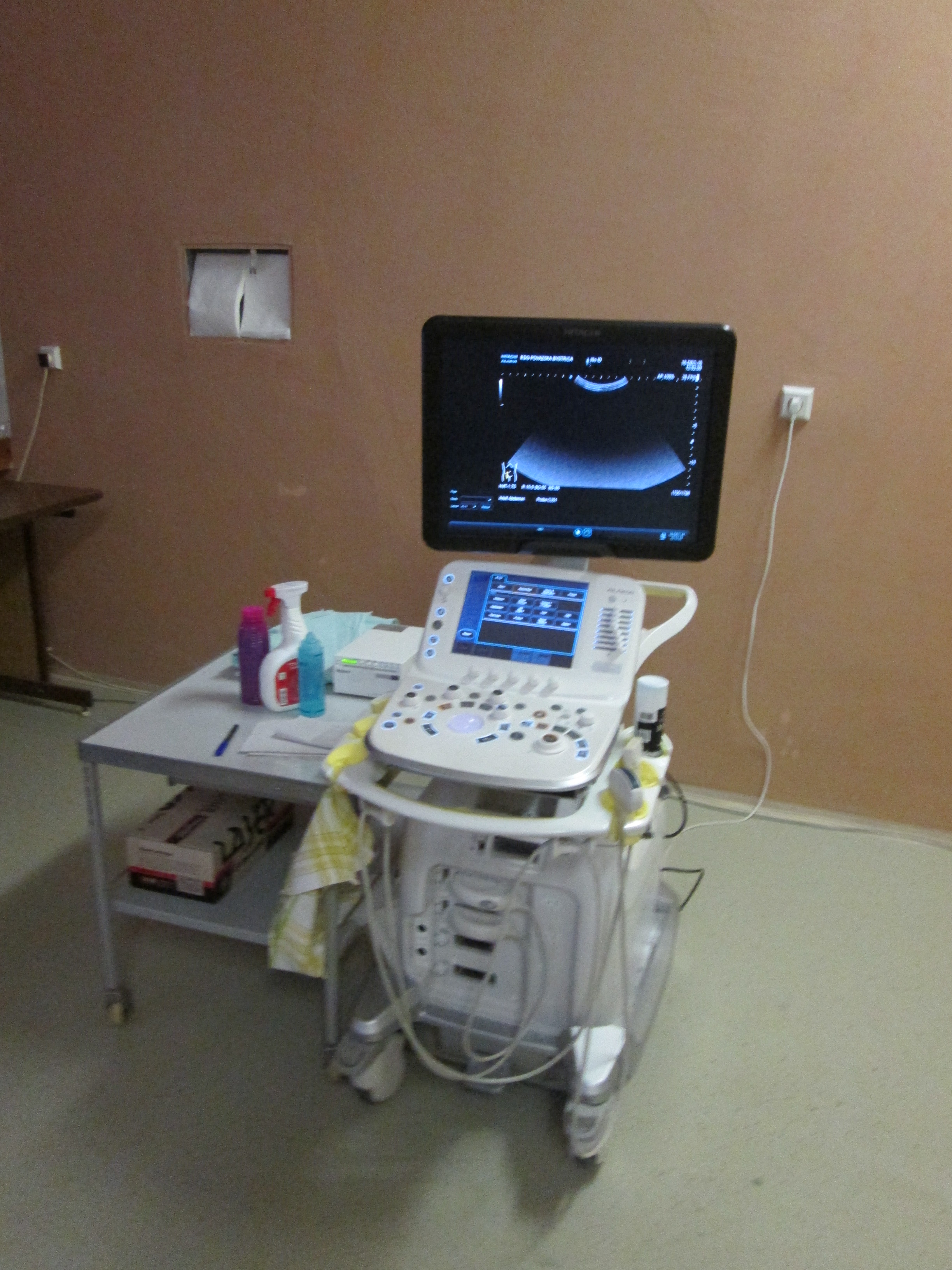 Nový ultrazvukový prístroj na RDG oddelení